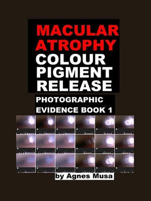 cover image of Macular Atrophy Colour Pigment Release, Photographic Evidence Book 1
